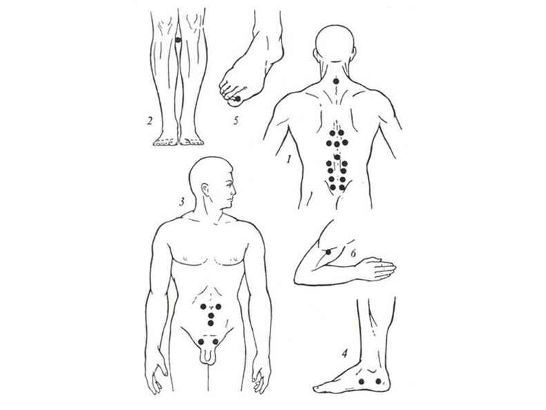 Acupuncture massage
